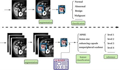 Fully automating LI-RADS on MRI with deep learning-guided lesion segmentation, feature characterization, and score inference